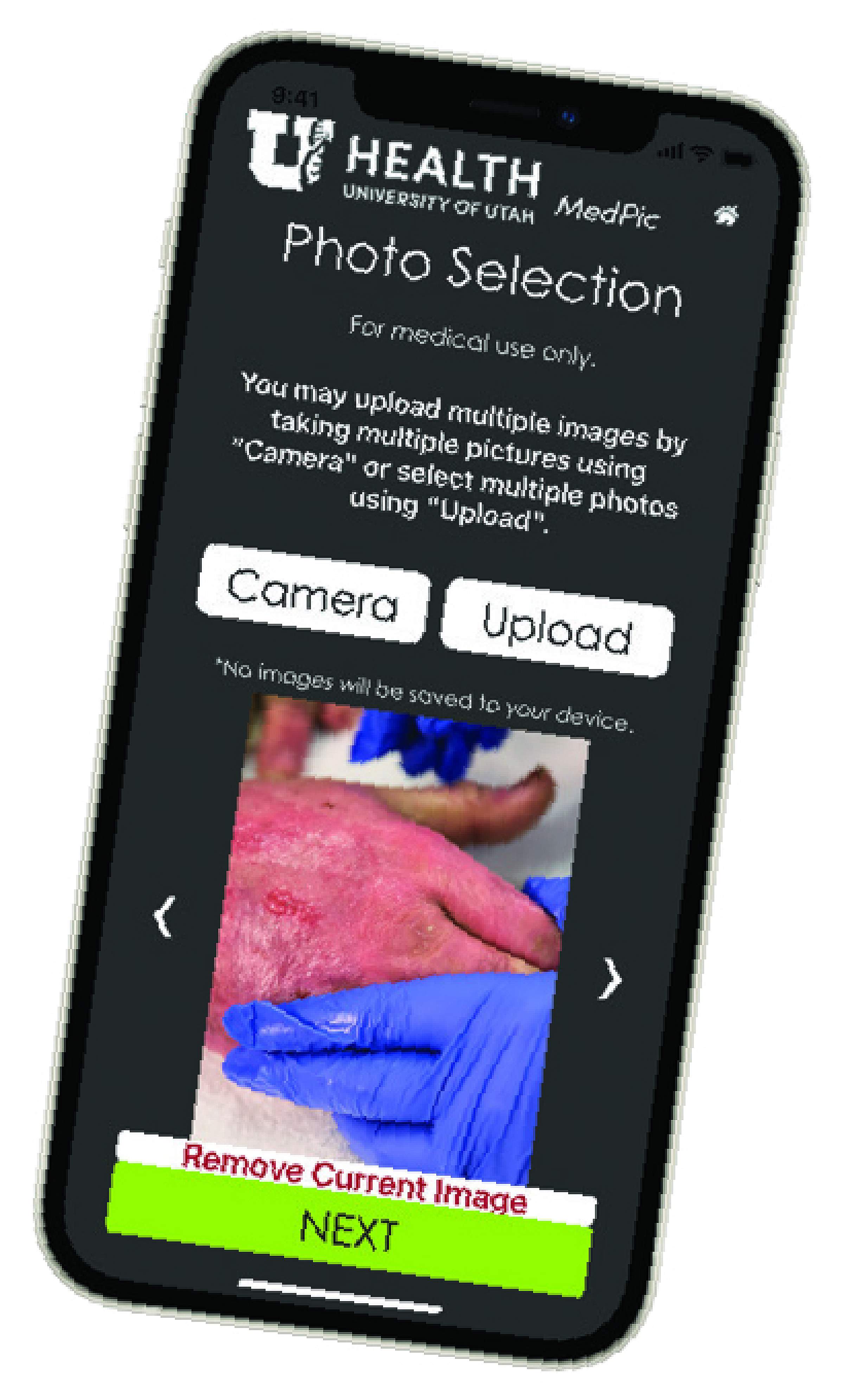 Burn Phone Image
