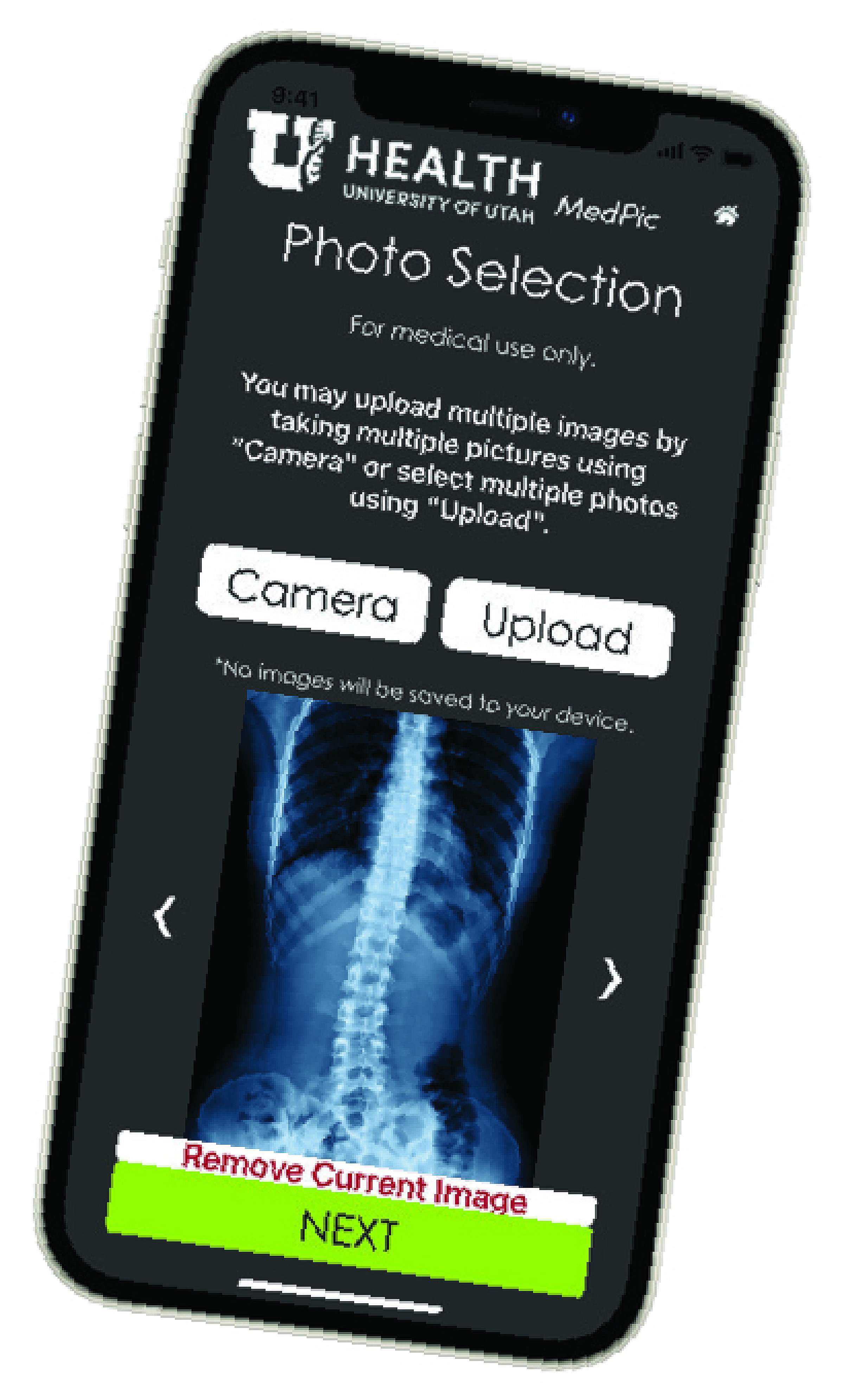Spine image MedPic App